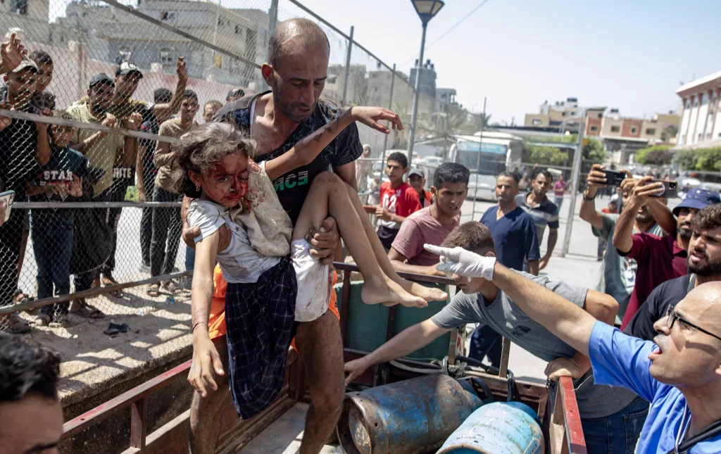 Injured Palestinians arrive at hospital following Israeli strike east of Khan Younis