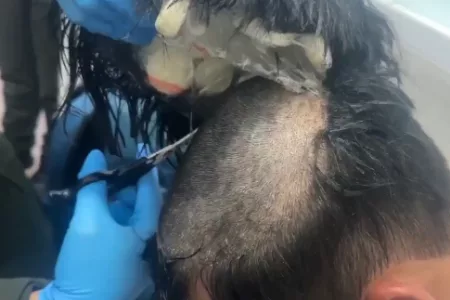 Colombian Man Caught Smuggling Cocaine Under Wig